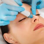Hydra Facial