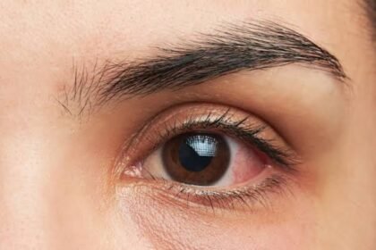 Eye Makeup Infection