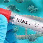 H1N1 Infection