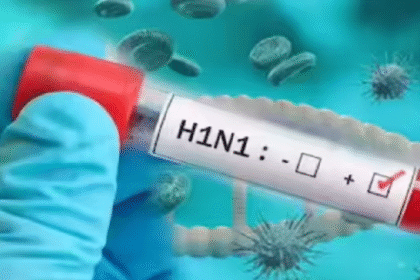 H1N1 Infection
