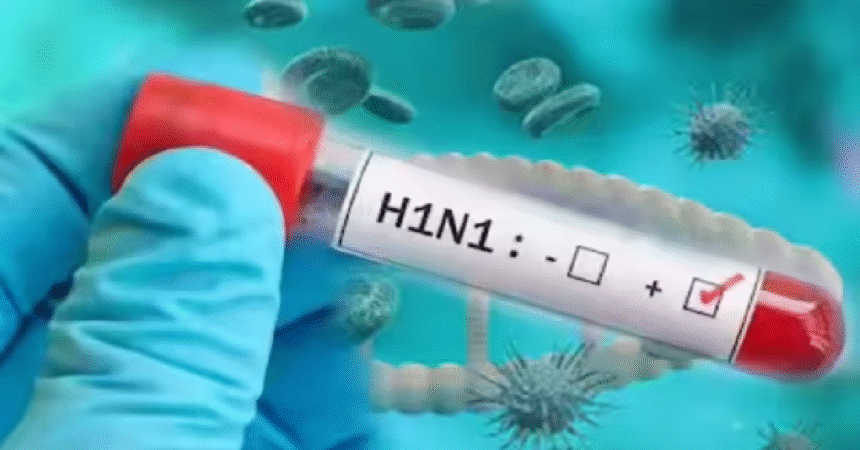 H1N1 Infection